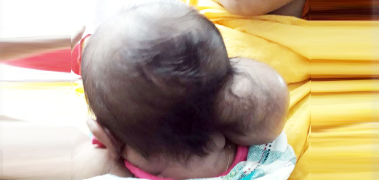 Paediatric Surgery